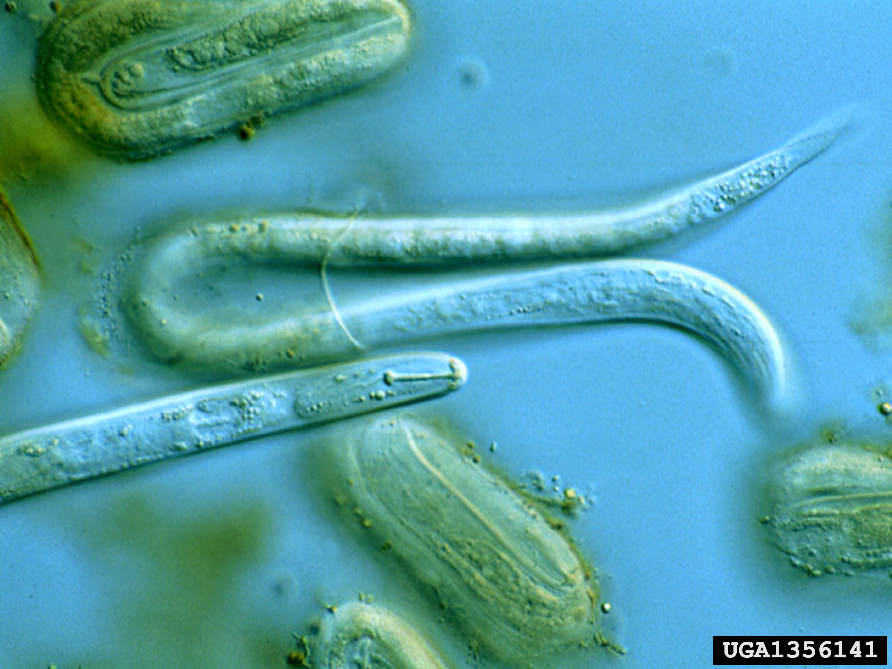 Second-stage juveniles and eggs of Globodera rostochiensis.